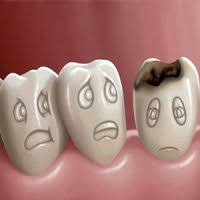 هر کودک 12 ساله چند دندان خراب دارد؟
