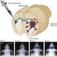 موفقیت استفاده از نانوذرات برچسب دار بر درمان جراحات مغز 1