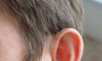 تأثیر سرطان بر شنوایی کودکان مبتلا به سرطان