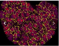 تصویر سلول‌های سرطانی قلبی شکل برنده جایز عکاسی علمی شد