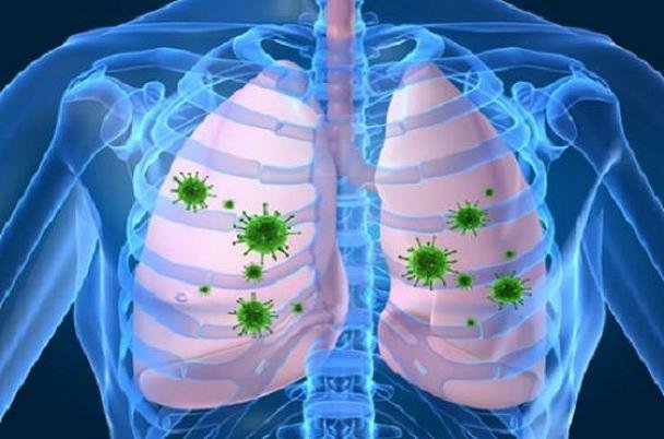 راه‌های پیشگیری از عفونت‌های تنفسی در فصل زمستان