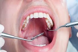 رعایت سلامت دهان و دندان را جدی بگیرید