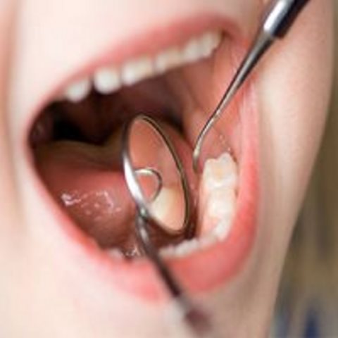 ارزیابی وضعیت سلامت دهان و دندان در کشور