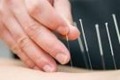 طب سوزنی برای درمان آلرژی ها وبی اشتهایی درکودکان مفید است
