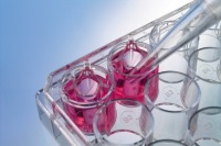 پیشرفت در درمان ام اس