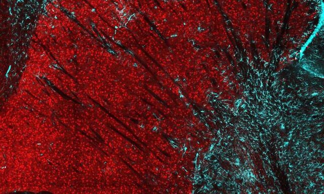 شناسایی عملکرد جدید پروتئین عامل بیماری "هانتینگتون"