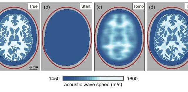 تصویربرداری لرزه‌ای و ارائه تصاویر دقیق از مغز