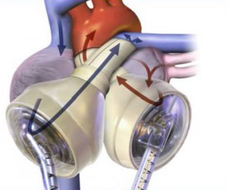 خلاصه درسنامه زیست دهم فصل 4 گفتار 3 (خون)- مهساسادات هاشمی