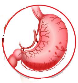 گوارش و جذب مواد - گوارش در معده