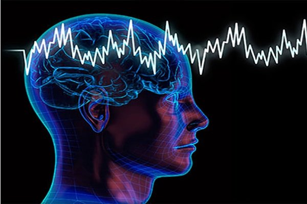 تحریک الکتریکی به تقویت حافظه کمک می‌کند