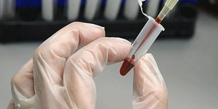 سانتریفیوژ دور بالای بانک خون ایرانی عرضه می‌شود