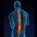 درباره بیماری"دویک" بیشتر بدانیم