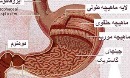 گیاه بهاری که "زخم معده" را درمان می‌کند