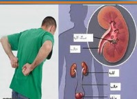 قاتل کلیه‌ها را بشناسید