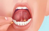 قرص زیر زبانی چگونه اثر می‌کند؟