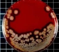 روش‌های طبیعی درمان عفونت خون