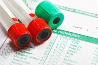 "D3"/ راهنمای تفسیر آزمایش خون در خانه