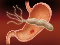 میکروب معده چیست؟