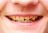 رابطه مستقیم "محیط کاری" با "پوسیدگی دندان ها"