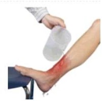 تسریع در بهبود زخم با استفاده از نانو پانسمان