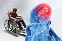 ویتامینD، متهم اصلی ام‌اس !