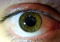 در فصل پاییز بیشتر مراقب چشمانتان باشید