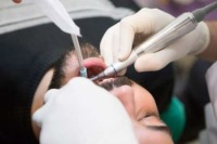 استرس احتمال پوسیدگی دندان را افزایش می‌دهد