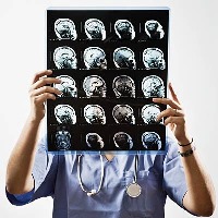 ام اس چیست؟