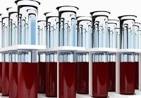 شلیک تیر کم‌خونی به سمت قلب