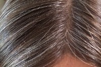 رفع سفیدی تارهای مو با این نسخه‌های گیاهی!