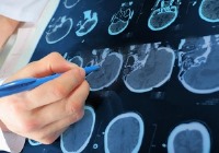 مبتلایان به «ام اس» از خوردن این غذاها خودداری کنند