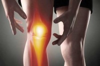 آرتروز زانو قابل پیشگیری است