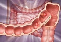 برای پاکسازی روده‌ها چه بخوریم؟