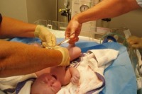 استفاده از سلول بنیادی در درمان فلج مغزی