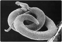 درمان بیماری های خود ایمنی با کرم های روده