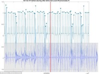 تبدیل ضربان قلب به موسیقی
