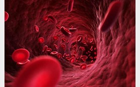 عوامل گرفتگی عروق چیست؟