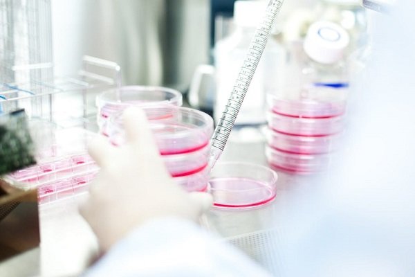 فردا اولین عمل کاشت سلول برای درمان پارکینسون انجام می‌شود