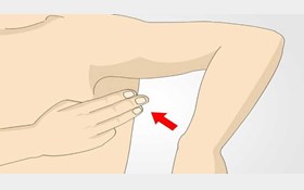 همه توده‌های زیر بغل سرطانی هستند؟