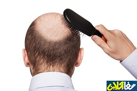 6 ماده غذایی برای تقویت موها