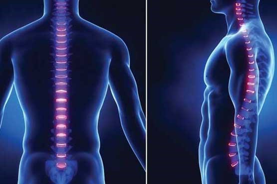 آشنایی با گودی کمر