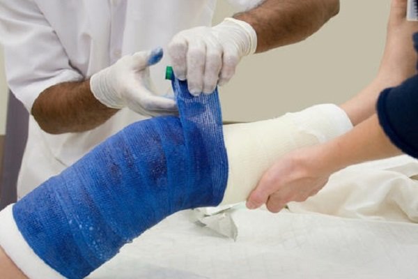 شناسایی سلول‌های بنیادین برای تسریع درمان شکستگی