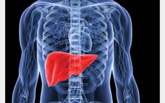 آنچه در مورد همانژیوم کبدی باید بدانید