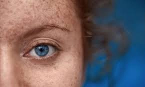 مهم‌ترین دلایل عوض شدن رنگ چشم