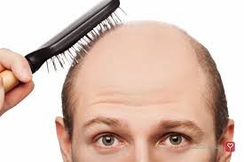 بخاطر کدام کمبودهای تغذیه‌ای دچار ریزش مو می‌شویم؟