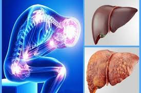 کلید غلبه بر کبد چرب