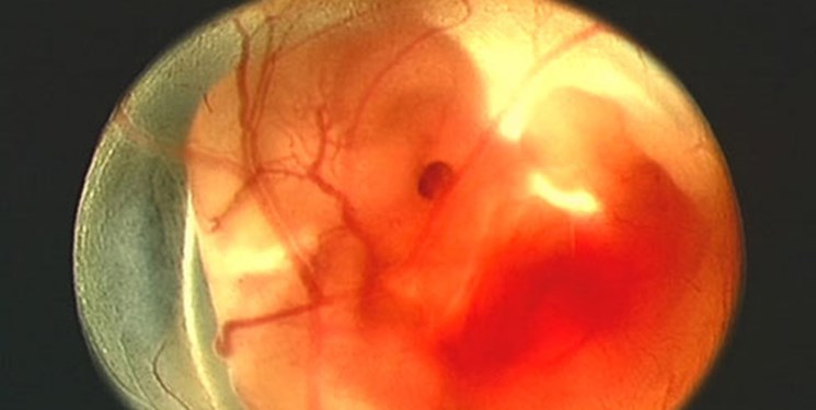 تولید پانسمان بیولوژیک برای زخم‌های حاد از پرده جنینی