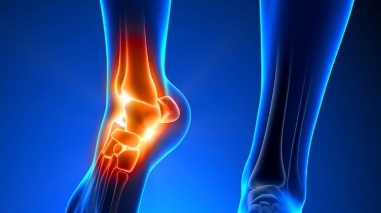 6 عادت اشتباه که سلامت استخوان‌هایتان را نشانه گرفته است