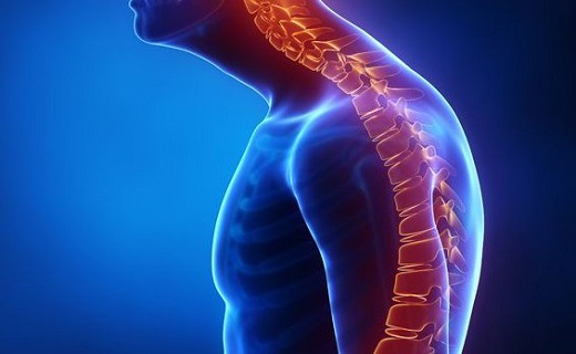 تمرین‌های خانگی برای درمان خمیدگی شانه + راه‌های پیشگیری