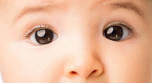 تمرین‌هایی برای کمک به انحراف چشم